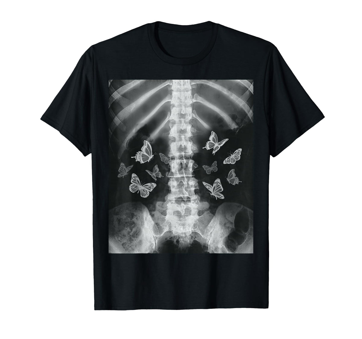 Skeleton Xray Butterfly Egirl Y2K T-Shirt - Streetwear Style Men Women